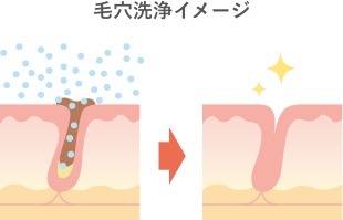 毛穴洗浄イメージ